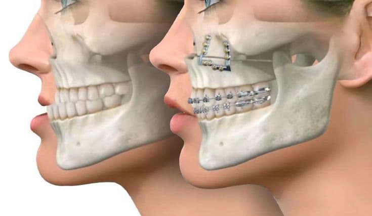 Facial Aesthetics at Kaleidoscope Dental Specialists, Marylebone London